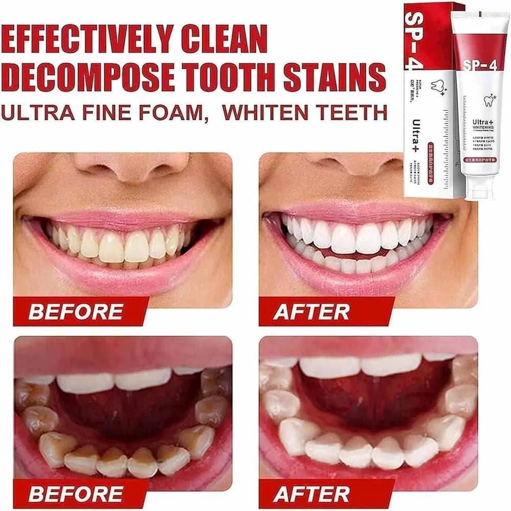 Yayashi SP-4 Ultra Whitening Toothpaste - Probiotic Stain Remover for Teeth, Fresh Breath, Gum Protection (100g) - Imported Gadget Xpres