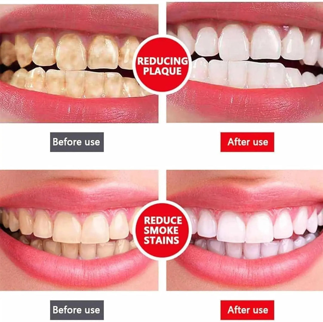 Yayashi SP-4 Ultra Whitening Toothpaste - Probiotic Stain Remover for Teeth, Fresh Breath, Gum Protection (100g) - Imported Gadget Xpres