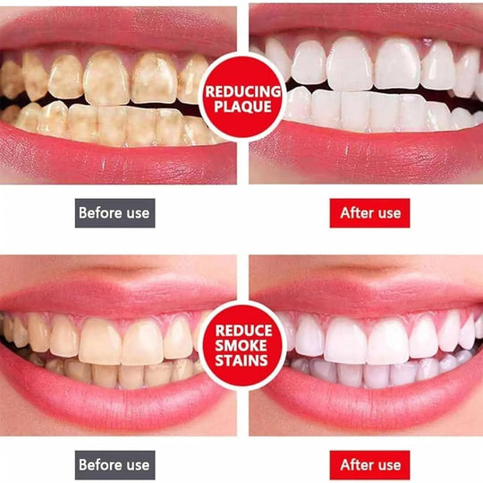Yayashi SP-4 Ultra Whitening Toothpaste - Probiotic Stain Remover for Teeth, Fresh Breath, Gum Protection (100g) - Imported Gadget Xpres